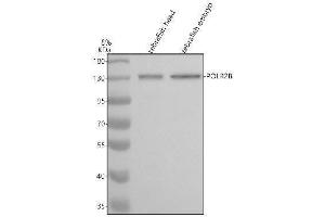 Western blot analysis of POLR2B using anti-POLR2B antibody (AZA0A8M1N6S0).