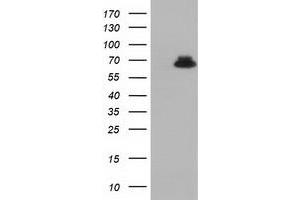Western Blotting (WB) image for anti-Epoxide Hydrolase 2, Cytoplasmic (EPHX2) antibody (ABIN1500855)