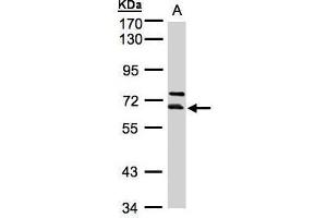 WB Image Sample(30 ug whole cell lysate) A:HeLa S3, 7. (THUMPD3 Antikörper)