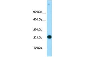 WB Suggested Anti-RGS19 Antibody Titration:  0.