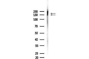 Western blot analysis of lysates from COLO205 cells(heat-shock,45 min treatment), using Phospho-NMDAR2B (Tyr1336) Antibody at 1/1000 dilution.
