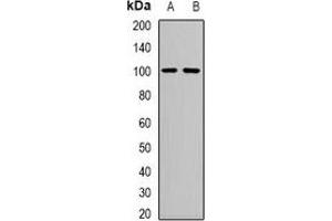 Western blot analysis of Neutral Ceramidase expression in mouse kidney (A), mouse heart (B) whole cell lysates. (ASAH2 Antikörper)