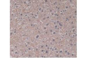 IHC-P analysis of Human Liver Tissue, with DAB staining. (TLR5 Antikörper  (AA 693-858))