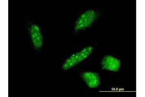 Immunofluorescence of monoclonal antibody to RNF24 on HeLa cell. (RNF24 Antikörper  (AA 49-148))