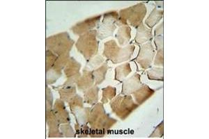 Immunohistochemistry (Paraffin-embedded Sections) (IHC (p)) image for anti-Cyclin-Dependent Kinase Inhibitor 2C (p18, Inhibits CDK4) (CDKN2C) (AA 113-139), (C-Term) antibody (ABIN654908)