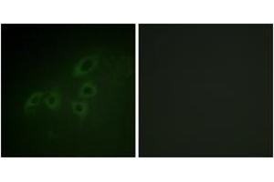 Immunofluorescence analysis of A549 cells, using JAK3 (Ab-785) Antibody. (JAK3 Antikörper  (AA 751-800))