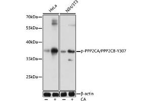 Western blot analysis of extracts of various cells, using Phospho-PPP2CA/PPP2CB-Y307 antibody (ABIN7269685) at 1:1000 dilution. (PPP2CB Antikörper  (pTyr307))