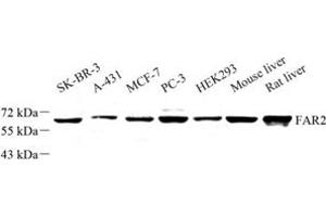 Western blot analysis of FAR2 (ABIN7073924) at dilution of 1: 500 (FAR2 Antikörper)