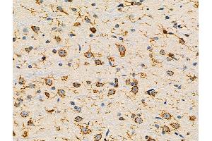 ABIN6265870 and ABIN6276708 at 1/100 staining Rat brain tissue by IHC-P. (UCP3 Antikörper  (C-Term))