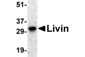 Western Blotting (WB) image for anti-Baculoviral IAP Repeat-Containing 7 (BIRC7) antibody (ABIN1031705) (BIRC7 Antikörper)