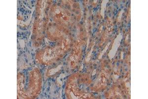 IHC-P analysis of Rat Tissue, with DAB staining. (N-Acetyl alpha-D-Glucosaminidase (AA 449-709) Antikörper)
