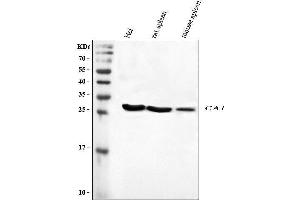Western blot analysis of CA1 using anti-CA1 antibody (ABIN3043766). (CA1 Antikörper  (AA 9-261))