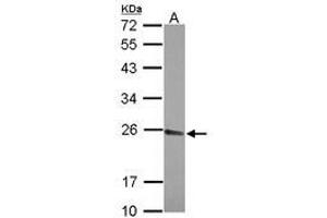 Image no. 1 for anti-Cleavage and Polyadenylation Specific Factor 4, 30kDa (CPSF4) (AA 31-216) antibody (ABIN1497600) (CPSF4 Antikörper  (AA 31-216))