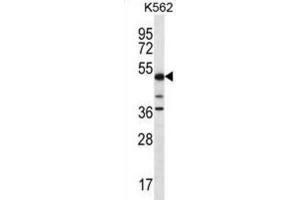 Western Blotting (WB) image for anti-Proline-serine-threonine Phosphatase Interacting Protein 1 (PSTPIP1) antibody (ABIN2996784) (PSTPIP1 Antikörper)