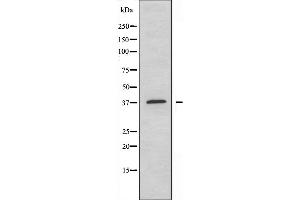Western blot analysis of extracts from HepG2 cells using EFNA3 antibody. (Ephrin A3 Antikörper  (C-Term))