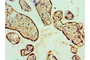 Immunohistochemistry of paraffin-embedded human placenta tissue using ABIN7143157 at dilution of 1:100 (ASCC3 Antikörper  (AA 1-111))