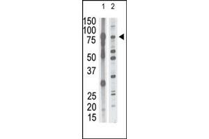 Western Blotting (WB) image for anti-Matrix Metallopeptidase 15 (Membrane-inserted) (MMP15) (N-Term) antibody (ABIN358688) (MMP15 Antikörper  (N-Term))
