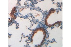 Used in DAB staining on fromalin fixed paraffin- embedded lung tissue (MUC5B Antikörper  (AA 3667-3771))