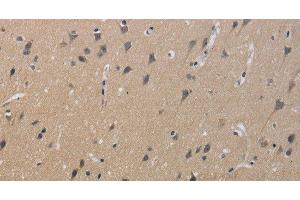 Immunohistochemistry of paraffin-embedded Human brain using KCNMB4 Polyclonal Antibody at dilution of 1:40 (KCNMB4 Antikörper)