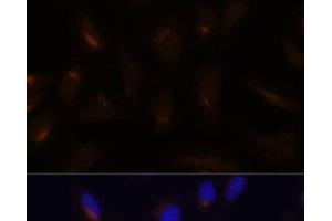 Immunofluorescence analysis of U-2 OS cells using FoxO3a Polyclonal Antibody at dilution of 1:100. (FOXO3 Antikörper)
