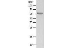 Western Blotting (WB) image for Lysyl-tRNA Synthetase (KARS) (AA 63-597) protein (His tag) (ABIN7123818) (KARS Protein (AA 63-597) (His tag))