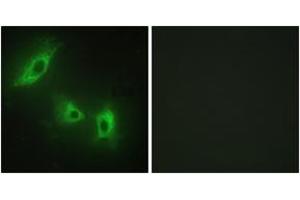 Immunofluorescence (IF) image for anti-Activin A Receptor, Type IB (ACVR1B) (AA 73-122) antibody (ABIN2889466) (Activin A Receptor Type IB/ALK-4 Antikörper  (AA 73-122))
