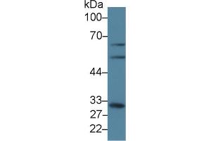 Western Blot; Sample: Human A431 cell lysate; Primary Ab: 5µg/ml Rabbit Anti-Human GCLM Antibody Second Ab: 0. (GCLM Antikörper  (AA 40-251))