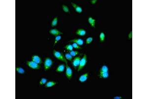 Immunofluorescent analysis of Hela cells using ABIN7142079 at dilution of 1:100 and Alexa Fluor 488-congugated AffiniPure Goat Anti-Rabbit IgG(H+L) (PHPT1 Antikörper  (AA 1-125))
