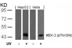 Image no. 2 for anti-Mitogen-Activated Protein Kinase Kinase 2 (MAP2K2) (pThr394) antibody (ABIN196622) (MEK2 Antikörper  (pThr394))