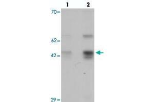 Western blot analysis of SLC35D3 in HeLa cell lysate with SLC35D3 polyclonal antibody  at (lane 1) 1 and (lane 2) 2 ug/mL.