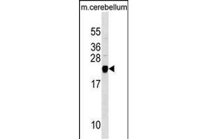 TAGLN3 Antibody (N-term) (ABIN1538865 and ABIN2849905) western blot analysis in mouse cerebellum tissue lysates (35 μg/lane).