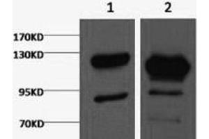 Western Blot analysis of 1) Jurkat, 2) Hela cells using Cleaved PARP1 Monoclonal Antibody at dilution of 1:2000. (PARP1 Antikörper  (cleaved))