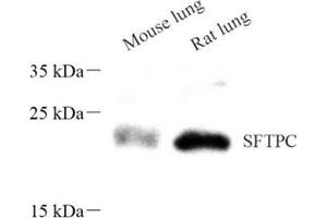 Western blot analysis of sftpc (ABIN7075216),at dilution of 1: 600 (Prosurfactant Protein C Antikörper)
