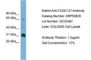 WB Suggested Anti-CCDC127  Antibody Titration: 0. (CCDC127 Antikörper  (N-Term))