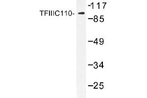 Image no. 1 for anti-General Transcription Factor IIIC, Polypeptide 2, beta 110kDa (GTF3C2) antibody (ABIN272244) (GTF3C2 Antikörper)