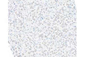 Immunohistochemistry (IHC) image for anti-Structural Maintenance of Chromosomes 1A (SMC1A) (C-Term) antibody (ABIN7455193) (Rekombinanter SMC1A Antikörper  (C-Term))