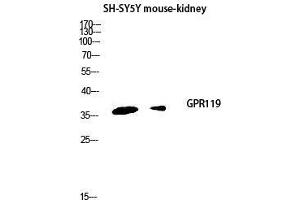 Western Blot (WB) analysis of SH-SY5Y Mouse Kidney lysis using GPR119 antibody. (G Protein-Coupled Receptor 119 Antikörper  (Internal Region))
