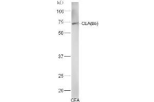 Human CEA lysates probed with Mouse Anti-CEA (B5) Monoclonal Antibody, Unconjugated (bsm-1624M) at 1:300 overnight at 4˚C. (CEA Antikörper)
