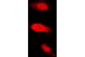 Immunofluorescent analysis of HuB staining in K562 cells. (HuB (Center) Antikörper)