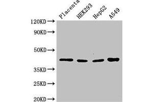Western Blotting (WB) image for anti-Hydroxy-delta-5-Steroid Dehydrogenase, 3 beta- and Steroid delta-Isomerase 1 (HSD3B1) (AA 127-267) antibody (ABIN7142284)