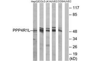 Western blot analysis of extracts from COLO/HuvEc/HepG2/Jurkat/COS cells, using PPP4R1L Antibody. (PPP4R1L Antikörper  (AA 191-240))