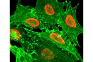 ICC/IF staining of HeLa cells treated with sodium butyrate using recombinant H2BK20ac antibody (red).
