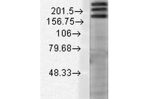 Western Blot analysis of Rat brain membrane lysate showing detection of SHANK1 protein using Mouse Anti-SHANK1 Monoclonal Antibody, Clone S22-21 . (SHANK1 Antikörper  (AA 469-691) (Atto 594))