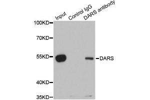 Immunoprecipitation analysis of 200 μg extracts of 293T cells using 1 μg DARS antibody (ABIN5973949). (DARS Antikörper)