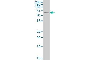 RIPK2 monoclonal antibody (M05), clone 7F5 Western Blot analysis of RIPK2 expression in HeLa . (RIPK2 Antikörper  (AA 431-540))