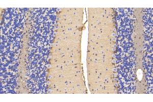 Immunohistochemistry (IHC) image for anti-Diazepam Binding Inhibitor (DBI) (AA 2-87) antibody (ABIN7435565)