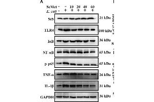 SeMet reversed activation of TLR4/NF-κB pathway induced by ESBL-E. (NF-kB p65 Antikörper  (pSer536))