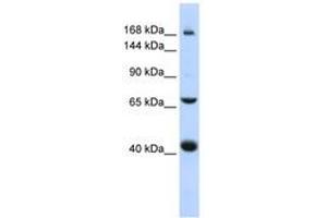 Image no. 1 for anti-ATP-Binding Cassette, Sub-Family C (CFTR/MRP), Member 9 (ABCC9) (AA 1440-1489) antibody (ABIN6740836) (ABCC9 Antikörper  (AA 1440-1489))