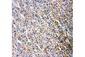 anti-Scavenger Receptor Class B, Member 1 (SCARB1) (AA 478-509), (C-Term) antibody