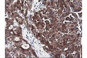 Image no. 6 for anti-F-Box Protein 21 (FBXO21) antibody (ABIN1498232) (FBXO21 Antikörper)